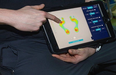Listing image_ Advancing Gait Analysis with StepSense